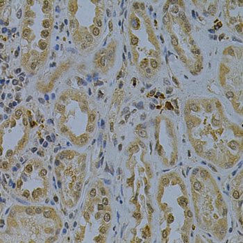 Anti-PDHA1 Antibody (CAB13525)