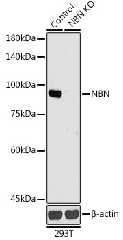 Anti-NBN Antibody [KO Validated] (CAB0783)