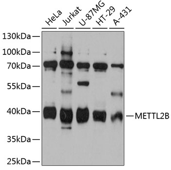 Anti-METTL2B Antibody (CAB12082)