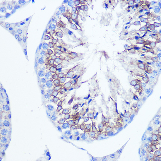 Anti-FSCN1 Antibody [KO Validated] (CAB1904)