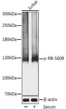 Anti-Phospho-RB1-S608 Antibody (CABP0570)