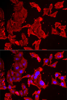 Anti-SMPX Antibody (CAB6744)