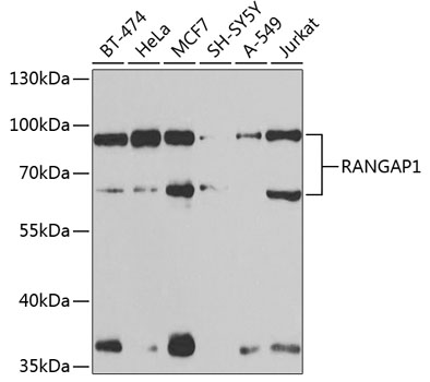 Anti-RANGAP1 Antibody (CAB13347)