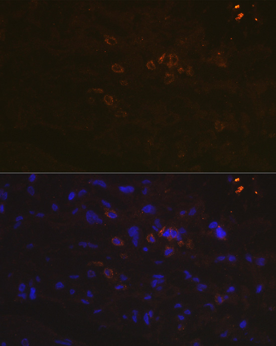 Anti-PD-L1 Antibody (CAB11273)