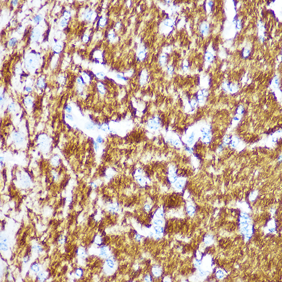 Anti-Myelin Basic protein Antibody (CAB1664)