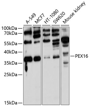 Anti-PEX16 Antibody (CAB10387)