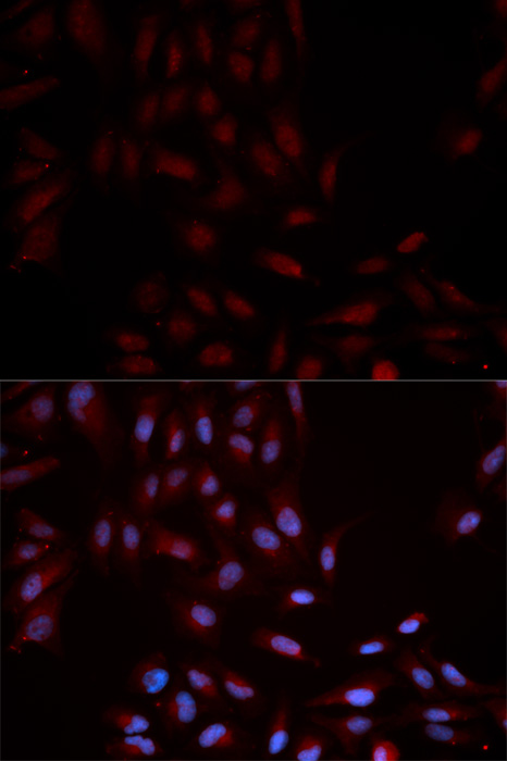 Anti-Phospho-MAPK14-Y322 Antibody (CABP0055)