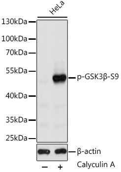 Anti-Phospho-GSK3B-S9 Antibody (CABP0039)