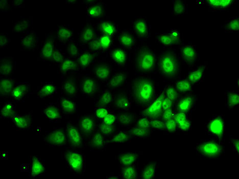 Anti-PPP2R1B Antibody (CAB6703)