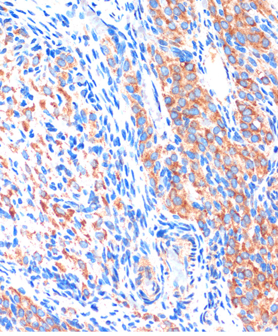 Anti-ME3 Antibody (CAB15787)