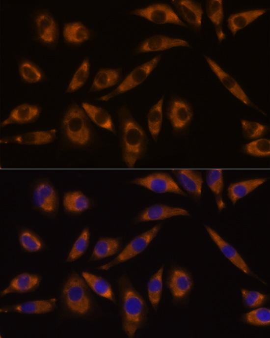 Anti-GNAQ Antibody (CAB14736)