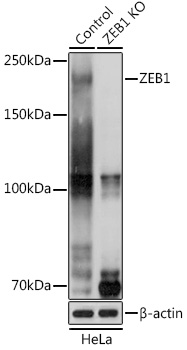 Anti-ZEB1 Antibody [KO Validated] (CAB1500)