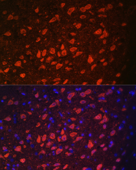 Anti-TRPM2 Antibody (CAB6137)