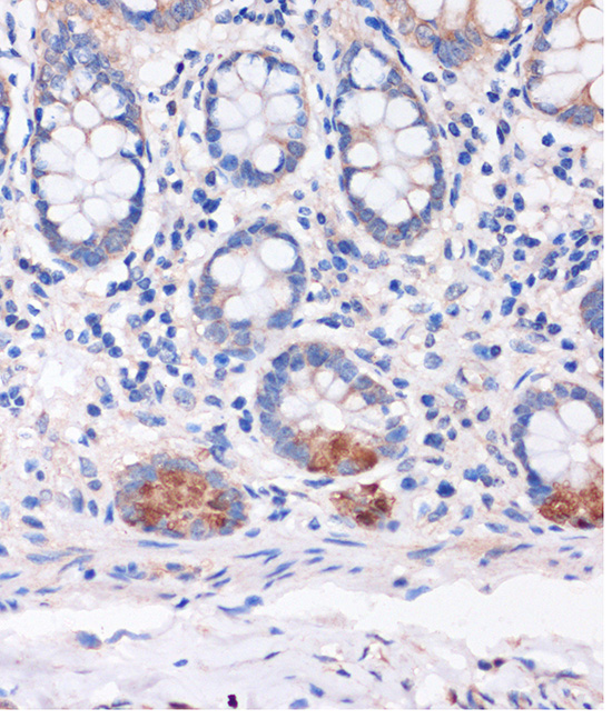 Anti-SMYD3 Antibody (CAB14516)