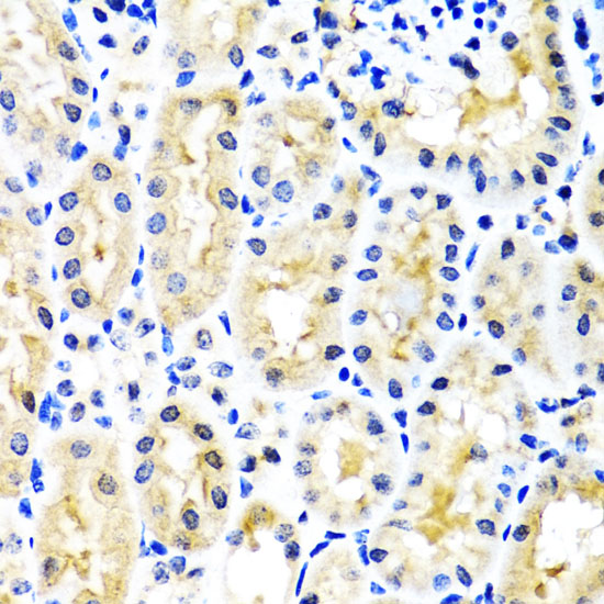 Anti-SNAP29 Antibody (CAB4290)