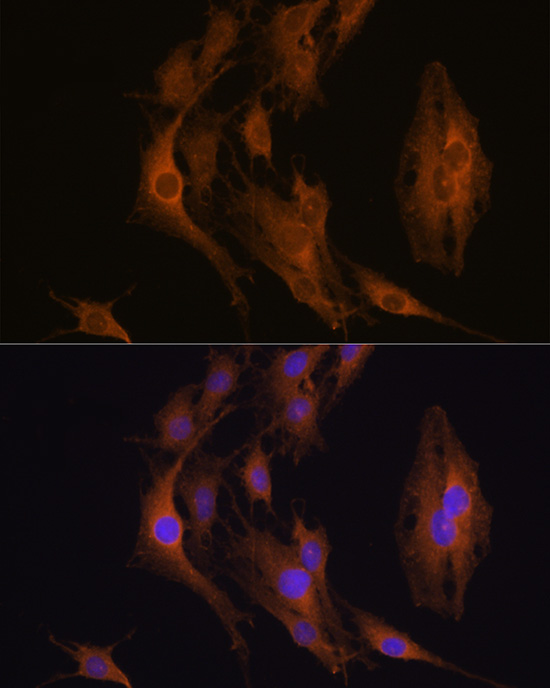 Anti-EIF2AK3 Antibody (CAB18196)