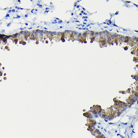 Anti-FUCA2 Antibody (CAB12211)