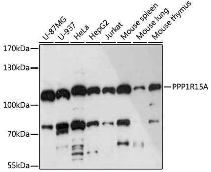 Anti-PPP1R15A Antibody (CAB16260)