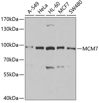 Anti-MCM7 Antibody (CAB1138)