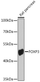Anti-FOXP3 Polyclonal Antibody (CAB8024)