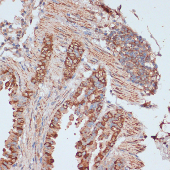 Anti-ACAT1 Antibody (CAB5335)