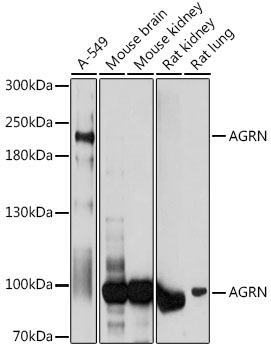 Anti-AGRN Antibody (CAB17320)