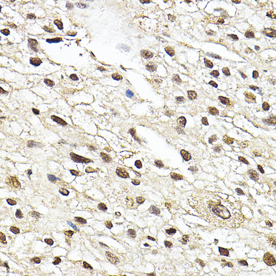 Anti-NR3C1 Antibody (CAB2164)