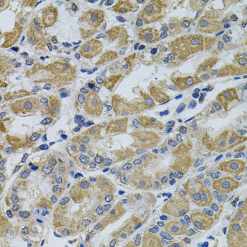 Anti-PTK7 Polyclonal Antibody (CAB9839)