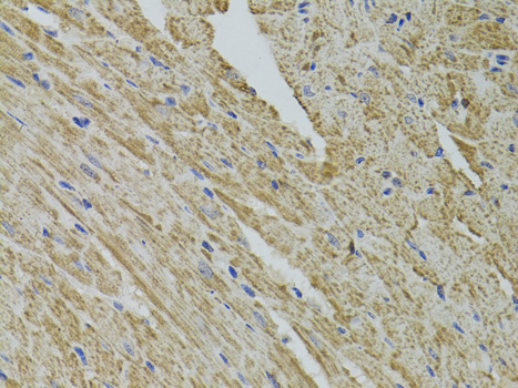 Anti-FHIT Antibody (CAB1196)