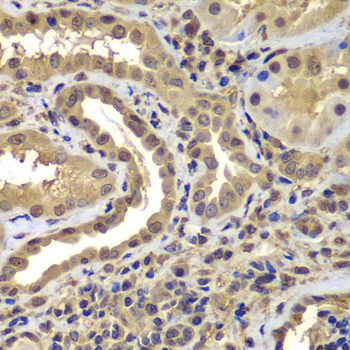 Anti-PSMB8 Antibody (CAB7340)