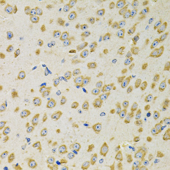 Anti-ADSS Antibody (CAB12398)