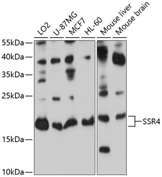 Anti-SSR4 Polyclonal Antibody (CAB8037)