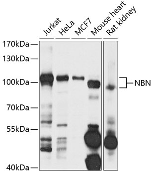 Anti-NBN Antibody (CAB7703)