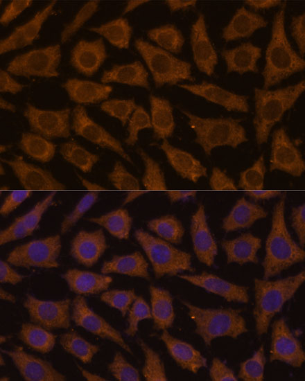 Anti-MTMR4 Antibody (CAB15349)