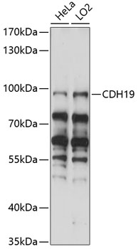 Anti-CDH19 Antibody (CAB14584)