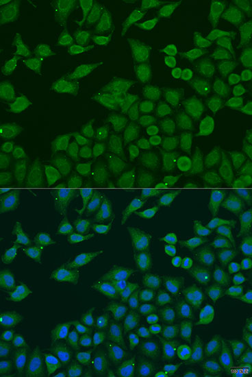 Anti-PLA2G4C Antibody (CAB7753)