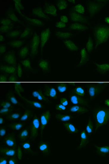 Anti-EPPIN Antibody (CAB2149)