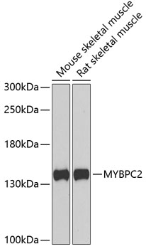 Anti-MYBPC2 Antibody (CAB6934)