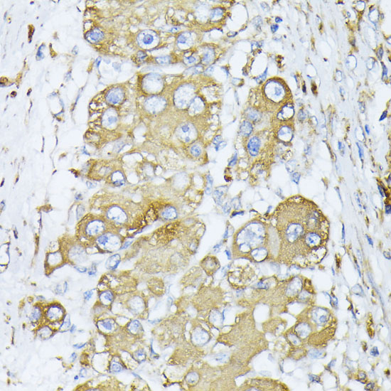 Anti-CALR Antibody (CAB1066)