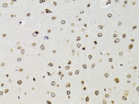 Anti-TMPO Antibody [KO Validated] (CAB2534)