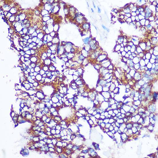 Anti-Smad2 Antibody [KO Validated] (CAB7699)