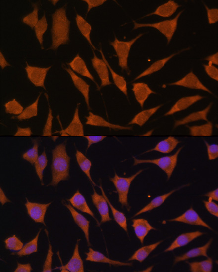 Anti-GLB1 Antibody (CAB1863)