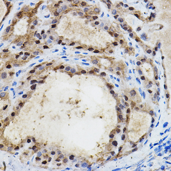 Anti-EPAS1/HIF2Alpha Antibody (CAB7553)