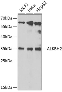 Anti-ALKBH2 Antibody (CAB6340)