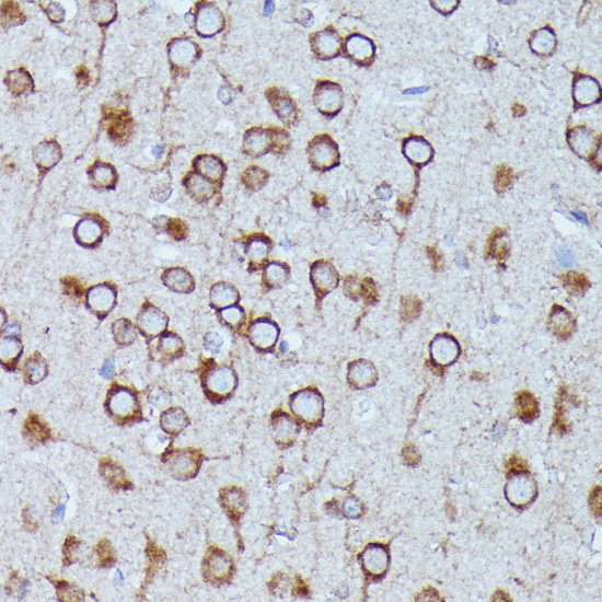 Anti-DDX6 Antibody (CAB16270)