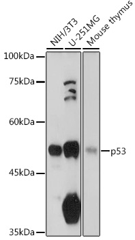 Anti-p53 Antibody [KO Validated] (CAB5761)