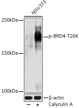 Anti-Phospho-BRD4-T204 Antibody (CABP1124)