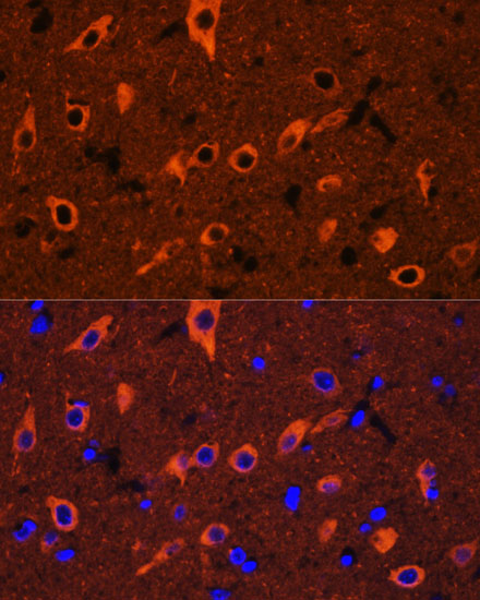 Anti-BetaIII-Tubulin Antibody [KO Validated] (CAB17074)