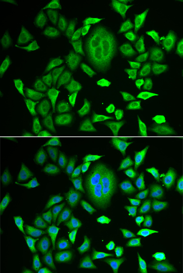 Anti-RBP3 Antibody (CAB6403)