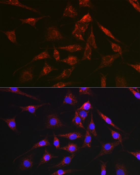 Anti-DCN Antibody (CAB15048)